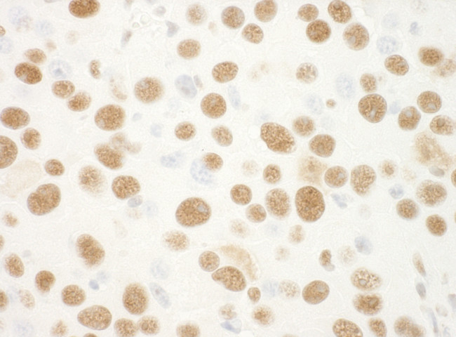 NPM1 Antibody in Immunohistochemistry (Paraffin) (IHC (P))