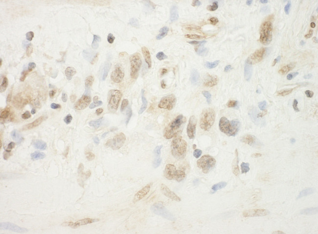 BHD Antibody in Immunohistochemistry (Paraffin) (IHC (P))