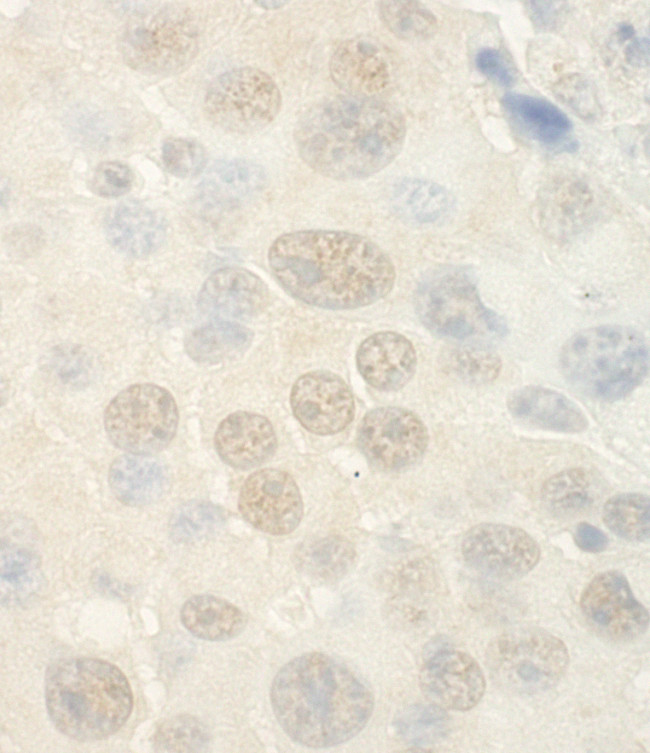 WDR5 Antibody in Immunohistochemistry (Paraffin) (IHC (P))