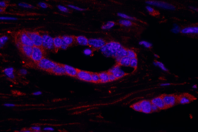 RSK2 Antibody in Immunohistochemistry (Paraffin) (IHC (P))