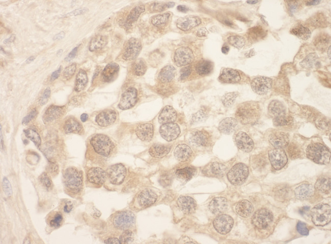 SRPK1 Antibody in Immunohistochemistry (Paraffin) (IHC (P))