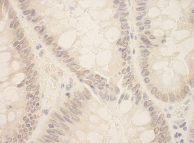 ZEB2/SIP Antibody in Immunohistochemistry (Paraffin) (IHC (P))