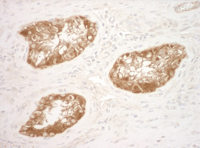 Vinculin Antibody in Immunohistochemistry (Paraffin) (IHC (P))