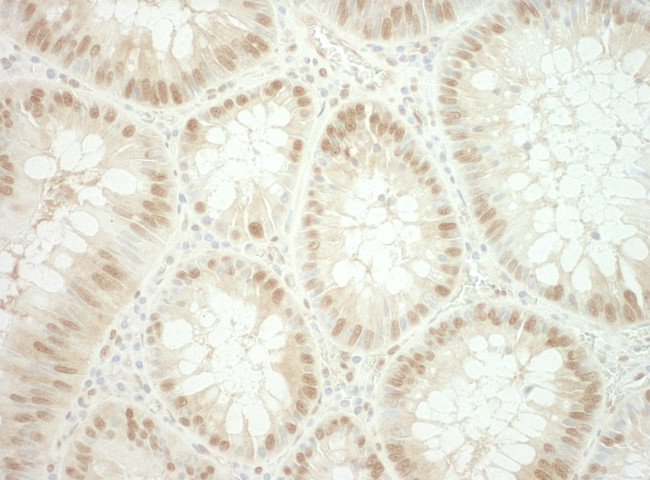 RuvBL2 Antibody in Immunohistochemistry (Paraffin) (IHC (P))