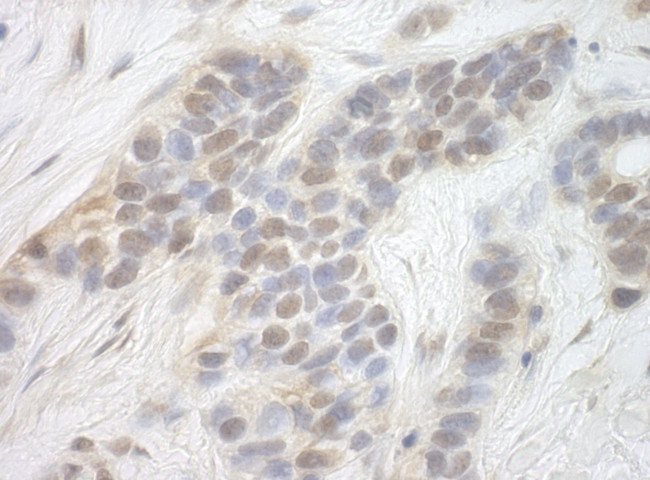 CDK8 Antibody in Immunohistochemistry (Paraffin) (IHC (P))