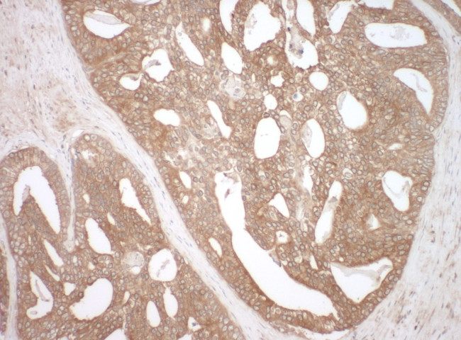 NEDD4L Antibody in Immunohistochemistry (Paraffin) (IHC (P))