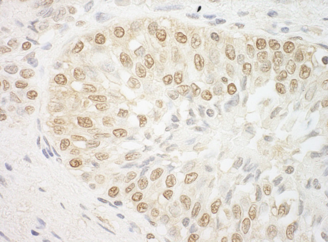 ARID3B Antibody in Immunohistochemistry (Paraffin) (IHC (P))