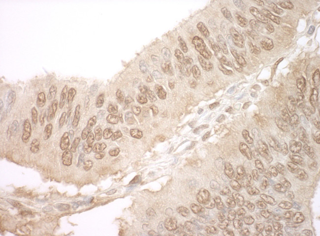 JMY Antibody in Immunohistochemistry (Paraffin) (IHC (P))