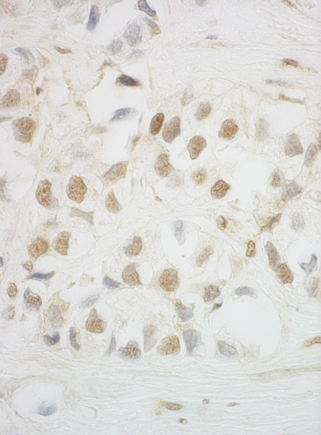 HCA66 Antibody in Immunohistochemistry (Paraffin) (IHC (P))