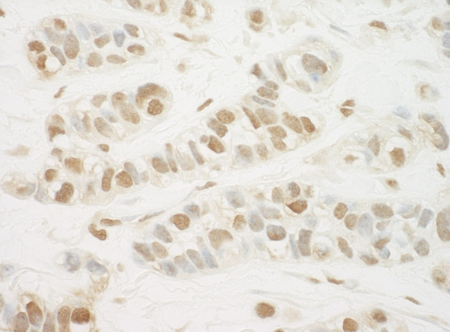 MED13L Antibody in Immunohistochemistry (Paraffin) (IHC (P))