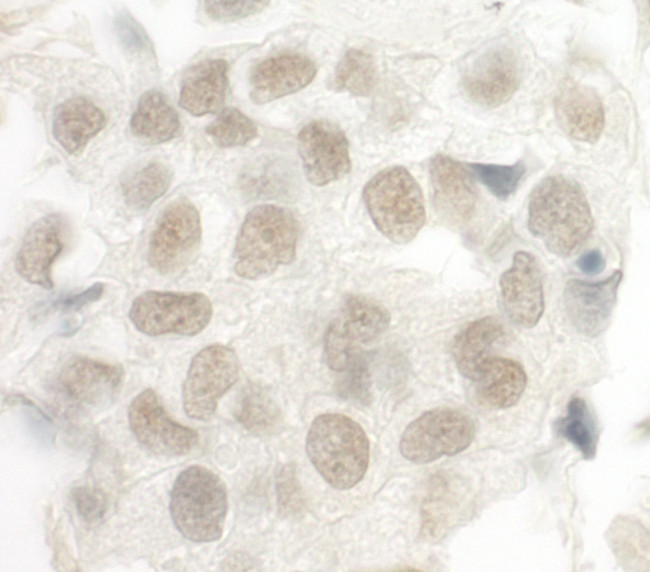 FOXP1 Antibody in Immunohistochemistry (Paraffin) (IHC (P))