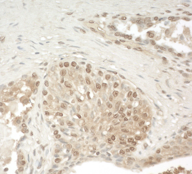 ZCCHC11 Antibody in Immunohistochemistry (Paraffin) (IHC (P))