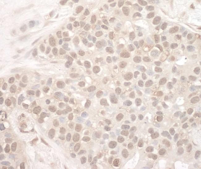 EYA2 Antibody in Immunohistochemistry (Paraffin) (IHC (P))