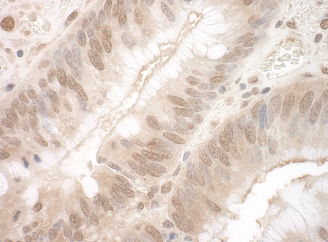 EYA3 Antibody in Immunohistochemistry (Paraffin) (IHC (P))