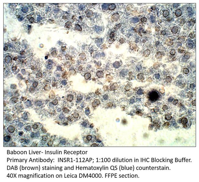 Insulin Receptor Antibody in Immunohistochemistry (IHC)