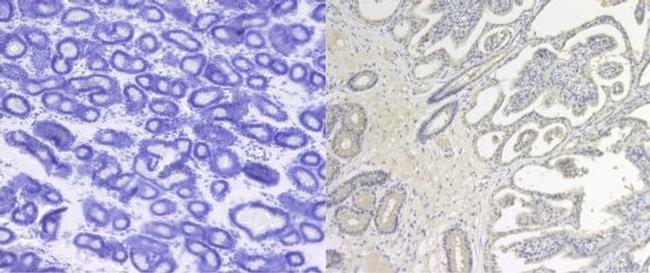 CD41 Antibody in Immunohistochemistry (Paraffin) (IHC (P))