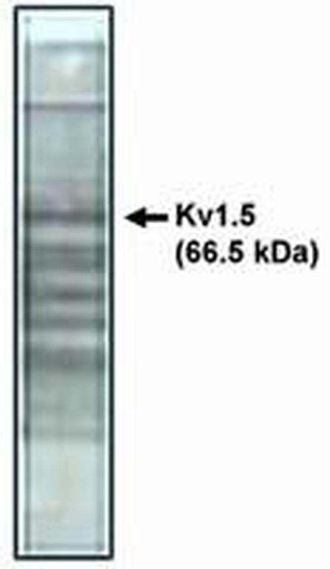 KV1.5 (KCNA5) Antibody in Western Blot (WB)