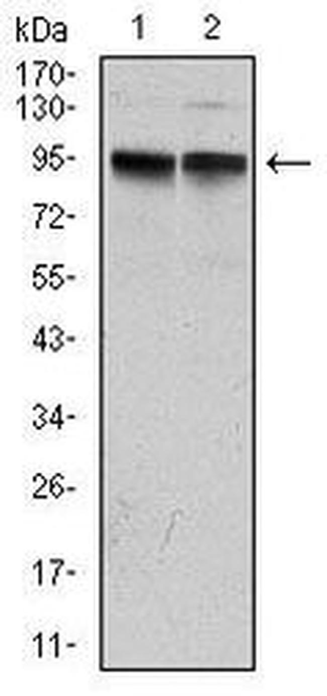 KCNQ1 Antibody in Western Blot (WB)