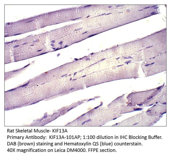 KIF13A Antibody in Immunohistochemistry (IHC)