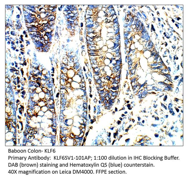 KLF6 SV1 Antibody in Immunohistochemistry (IHC)