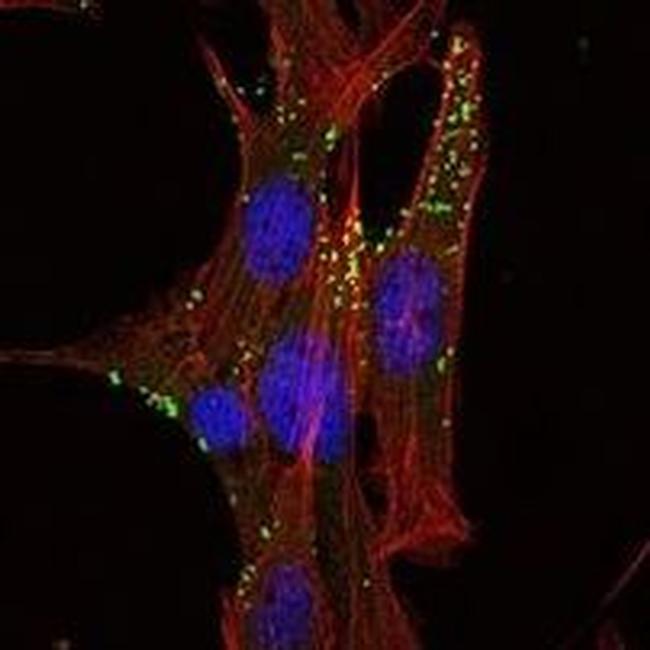 KLHL1 Antibody in Immunocytochemistry (ICC/IF)