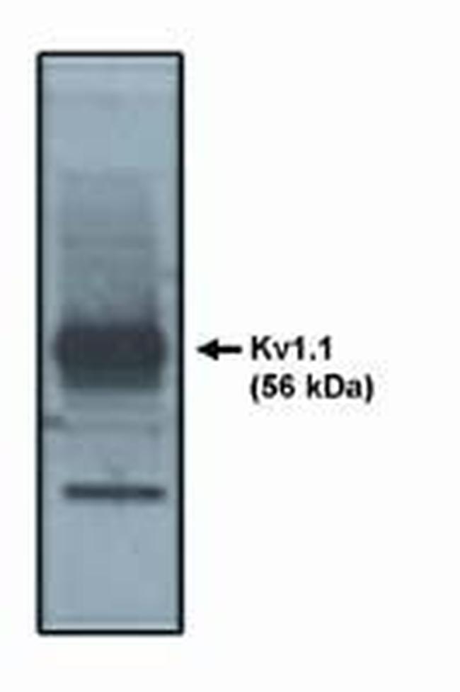 KV1.1 (KCNA1) Antibody in Western Blot (WB)