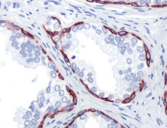 Cytokeratin 14 Antibody in Immunohistochemistry (Paraffin) (IHC (P))