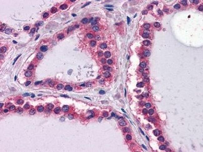 Laminin beta-1 Antibody in Immunohistochemistry (Paraffin) (IHC (P))