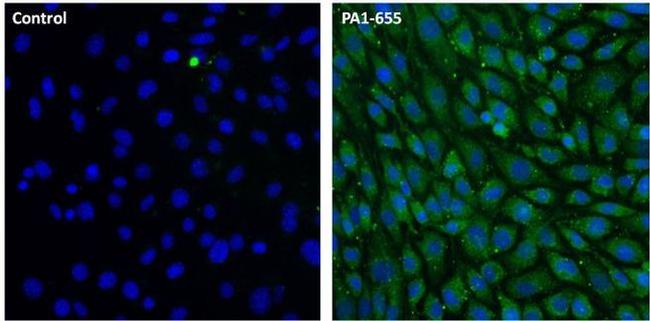 LAMP2 Antibody in Immunocytochemistry (ICC/IF)