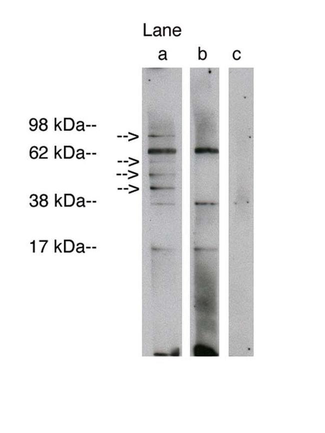 Lass1 Antibody in Western Blot (WB)