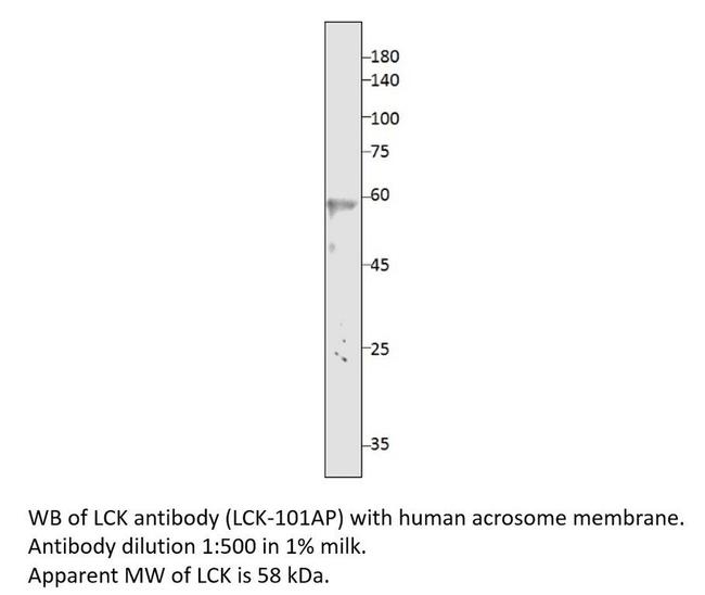 Lck Antibody in Western Blot (WB)