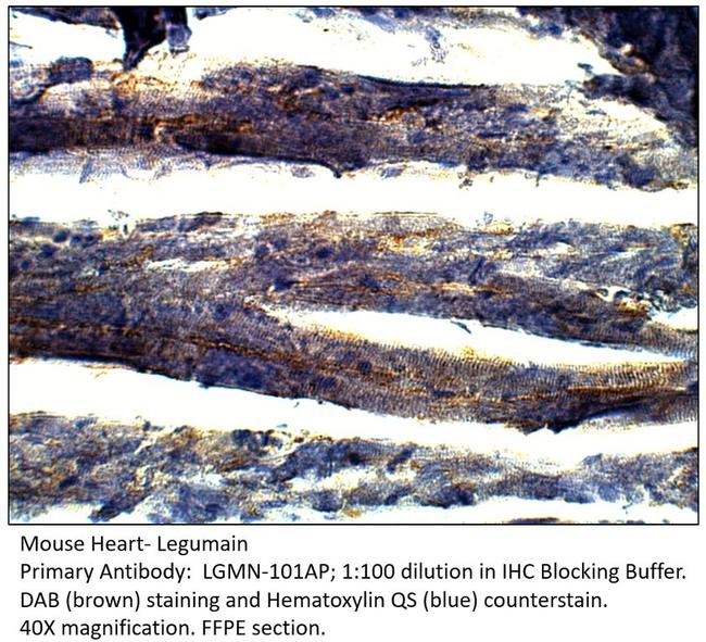 Legumain Antibody in Immunohistochemistry (IHC)