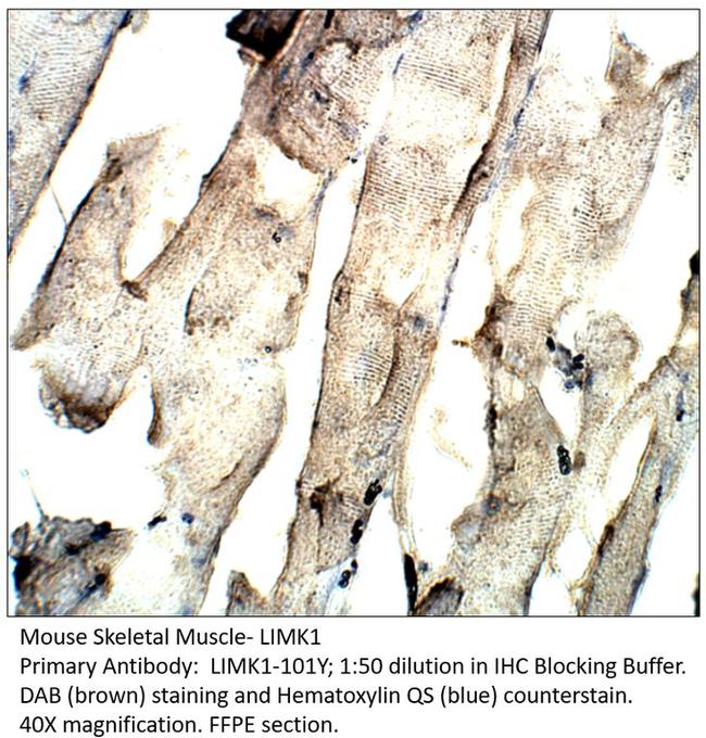 LIMK1 Antibody in Immunohistochemistry (IHC)