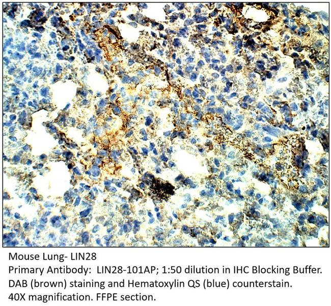 Lin28 Antibody in Immunohistochemistry (IHC)