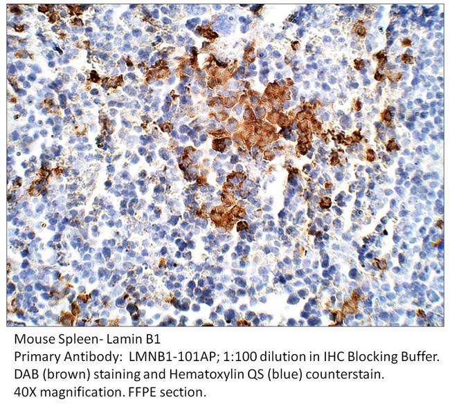 Lamin B1 Antibody in Immunohistochemistry (IHC)