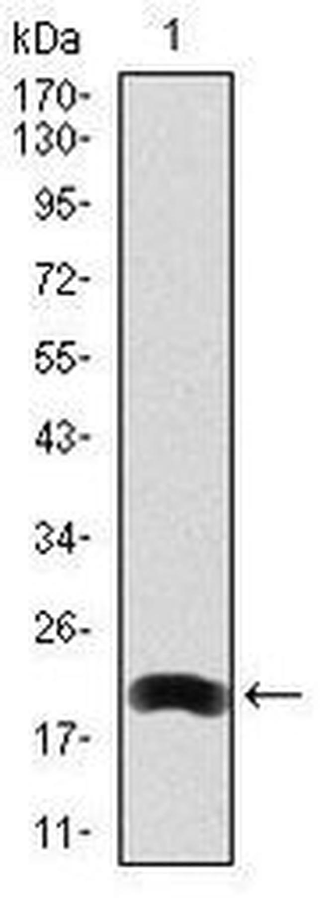 LRP5 Antibody in Western Blot (WB)