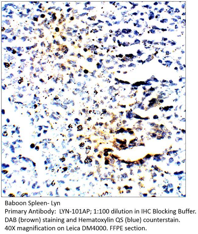 Lyn Antibody in Immunohistochemistry (IHC)