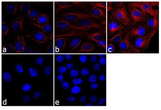 Mouse IgG (H+L) Cross-Adsorbed Secondary Antibody in Immunocytochemistry (ICC/IF)