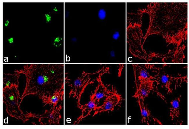 IL-8 (CXCL8) Antibody in Immunocytochemistry (ICC/IF)