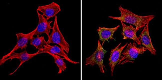 RAP1A Antibody in Immunocytochemistry (ICC/IF)