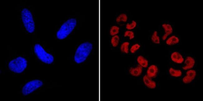 SOX2 Antibody in Immunocytochemistry (ICC/IF)