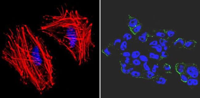 SSEA3 Antibody in Immunocytochemistry (ICC/IF)