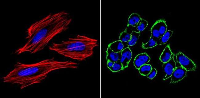 SSEA4 Antibody in Immunocytochemistry (ICC/IF)