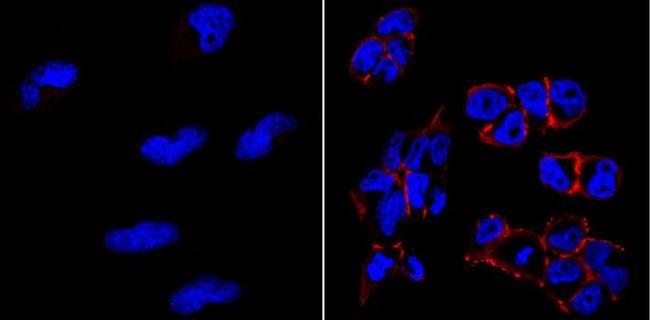 TRA-1-81 Antibody in Immunocytochemistry (ICC/IF)