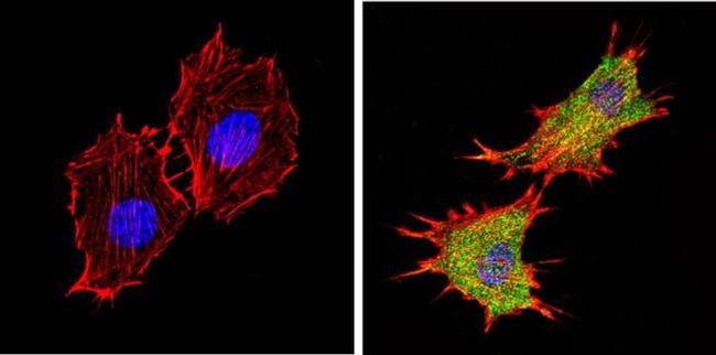 AKT2 Antibody in Immunocytochemistry (ICC/IF)