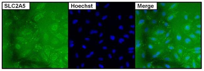 SLC2A5 Antibody in Immunocytochemistry (ICC/IF)