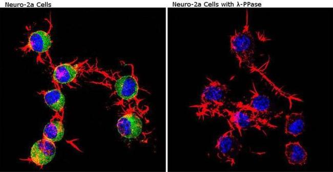 Phospho-CaMKII alpha (Thr286) Antibody in Immunocytochemistry (ICC/IF)