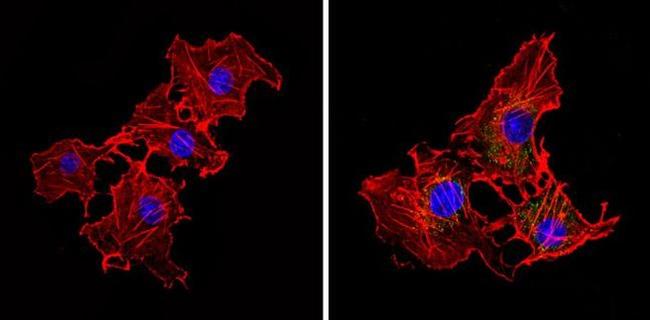 eIF2b gamma Antibody in Immunocytochemistry (ICC/IF)