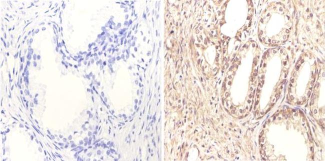 FOXA1 Antibody in Immunohistochemistry (Paraffin) (IHC (P))