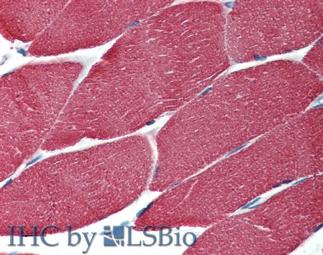 Actin Muscle Antibody in Immunohistochemistry (Paraffin) (IHC (P))